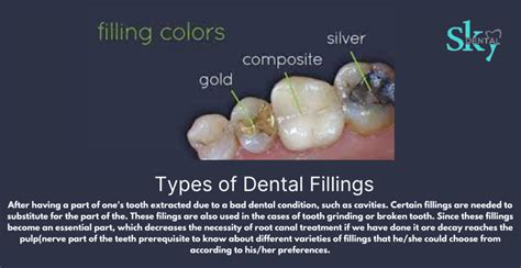 Dental Fillings: Purpose, Types, Risks, What to .